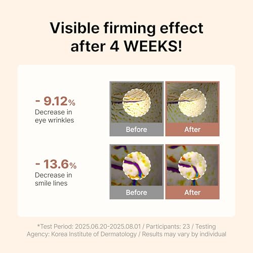 Siore NMN Intensive Serum | Plumping, Firming and Glow Face Serum with 99% Purity NMN 10,000ppm, Salmon DNA PDRN and Pycnogenol | Korean Pharmacy Anti-Aging Skin Care