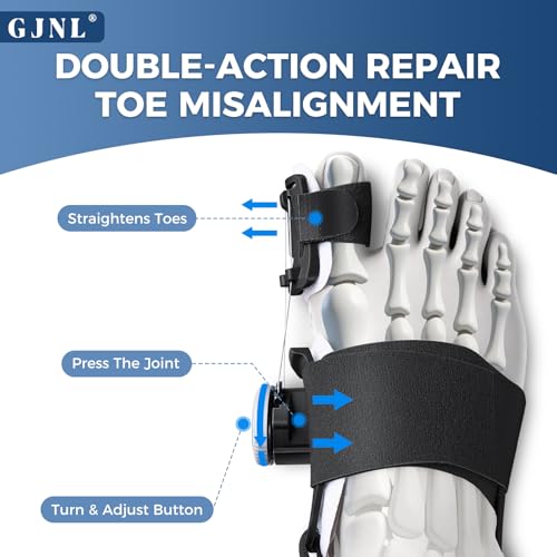 GJNL Bunion Corrector for Women & Men – Upgraded Adjustable Bunion Fix for Big Toe Separation Pain Relief, Bunion Splint Suitable for Left/Right Feet, Toes Alignment Hallux Valgus Correction (Black) Black
