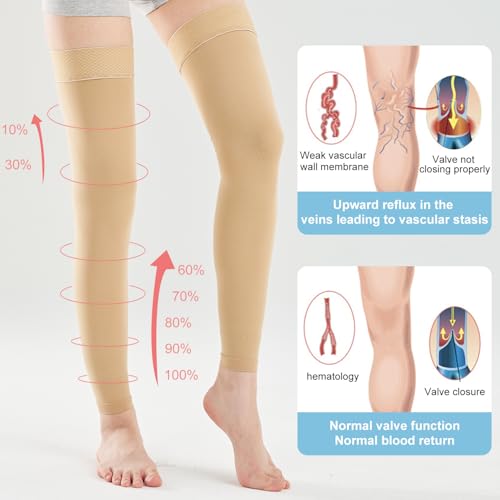 Medical Thigh High Compression Socks Footless for Women and Men (Pair), 15-20 mmHg with Silicone Dot Band, Medical Compression Stockings for Varicose Veins XL BEIGE