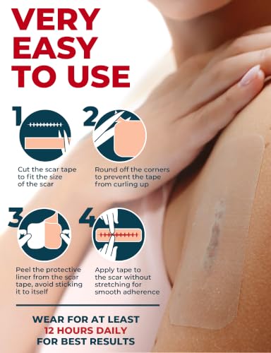 Medical Grade Silicone Scar Tape - 1.6"x70" - Effective Scar Removal 70"x1.6" Beige