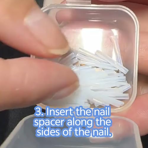 Ingrown Toenail Corrector Kit - Professional Painless Correction Strips & Pedicure Tools for At-Home Care