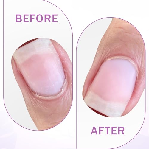 TIESOME Metal Cuticle Pusher, Circle Bevel Double-Ended Nail Cuticle Pusher Tool with 100 Grit Sandpaper Sheets Stainless Steel Manicure Pedicure Nail Art Care Tools for Fingernails Toenails