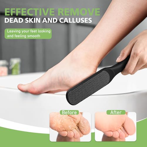 BALUCA Glass Foot File Callus Remover for Feet, Heel Scraper Black