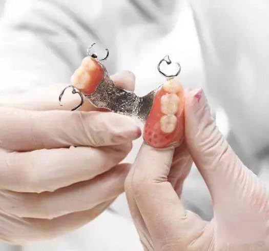 Denture Fake Teeth - Do it Yourself Full or Part Top and Bottom Fake Teeth at Home, Repair Missing Teeth, Improve Smile(Gypsum Model， Gum Material and Fake Teeth)