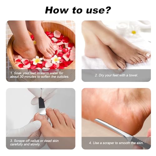 7 Pcs Professional Pedicure Tools for Feet, Stainless Steel Ingrown Toenail Removal Blade Kit with File, Toe Nail Knife Set for Men Women,Corn and Rasp Callus Remover Foot Scraper for Dead Skin