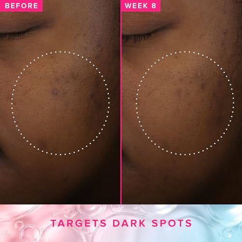 Farmacy 3% TXA Brightening Toner for Face - Dark Spot Corrector with Azelaic Acid, Tranexamic Acid + 5% PHA - Helps Even Texture + Tone, Fade Dark Spots + Exfoliate - Glow-Enhancing Skin Care (50ml) 1.7 Fl Oz (Pack of 1)