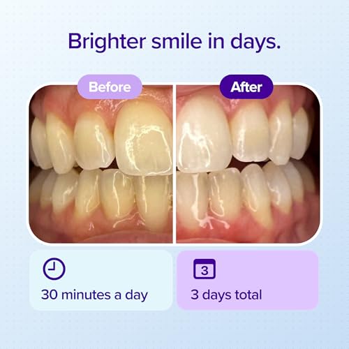 BURST Prefilled Teeth Whitening Trays (6 Trays/3 Treatments) | Gel Trays