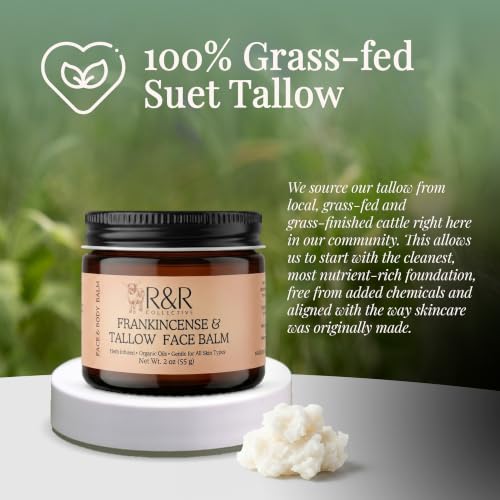 R&R Collective Frankincense Tallow Face Moisturizer – 100% Grass-Fed Whipped Beef Tallow Balm for Dry, Sensitive Skin, Eczema & Psoriasis – Handmade Natural Skincare – 2 oz
