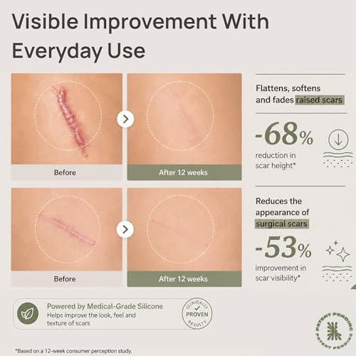 HydroSil Scar Gel 30ml | 7 Actives in Silicone with Niacinamide, Ectoin & Madecassoside | Quick-Drying Medical-Grade Silicone Gel for Surgical, Acne, Keloid & Hypertrophic Scars | Face & Body