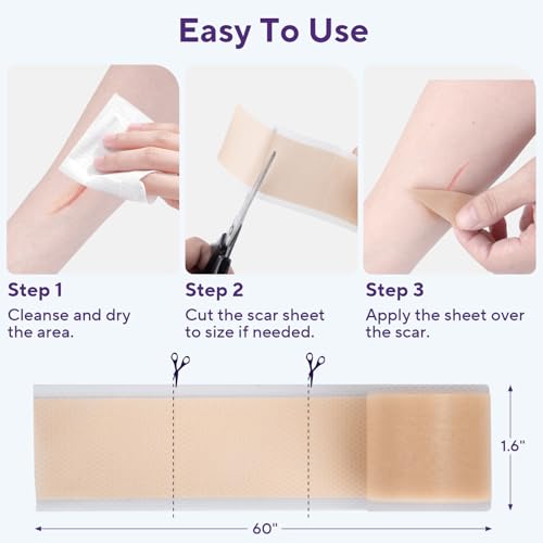 Silicone Scar Sheets, Silicone Scar Tape (1.6"x 60" Roll-1.5m) 1.5M