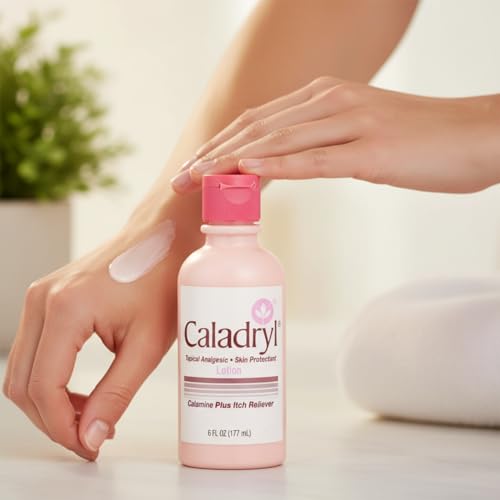 Caladryl Calamine Lotion for Itching, Insect Bites & Poison Ivy, 6 Fl Oz 6 Fluid Ounces 1