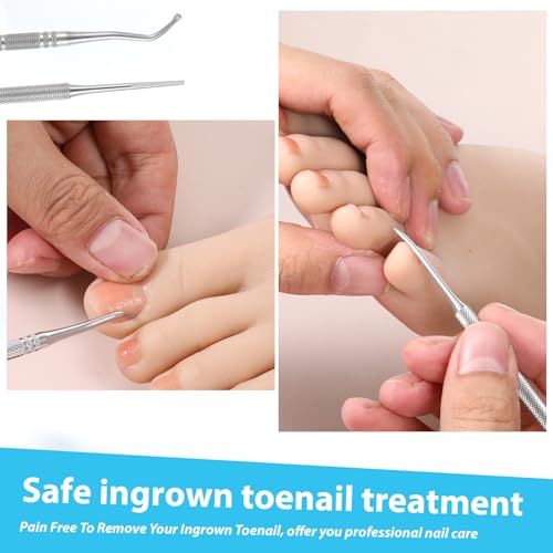 3 Pcs Pedicure Tools for Feet Ingrown Toenail File and Lifters Upgraded Professional Ingrown Toenail Treatment Double Head Nail Cleaning Tools Under Sidewall Cleaner Pain Relief Accessories