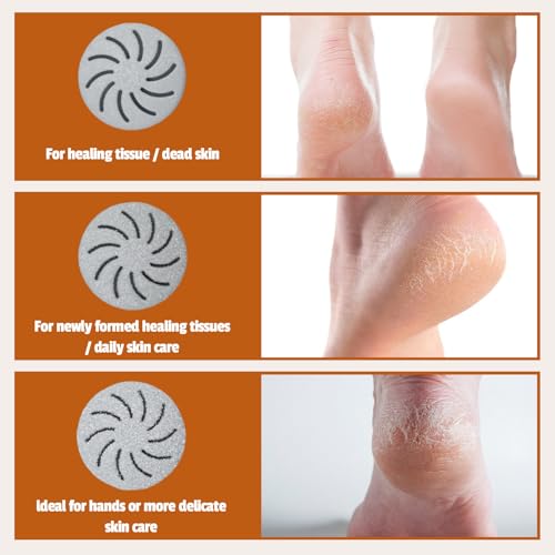 Electric Foot Scrubber File Callus Remover with Absorb Function, Waterproof Foot Grinder Cracked Dry Dead Skin Removal for Feet Care, 3 Rollers, 2 Speed, Battery Display