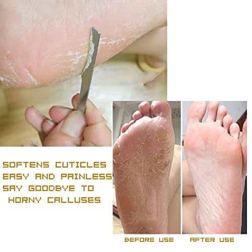 3PCS Stainless Steel Ingrown Toenail Pedicure Knife Set, Professional Foot Repair Sharp Blade Kit for Nail Corn Callus