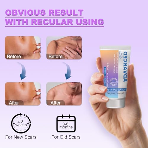 Silicone Scar Cream Scar Gel - Advanced Scar Treatment Keloid Bump Removal for Surgical Scars, C-Section, Injury, Stretch Marks, Acne, Burns, Keloids, Old & New Scars, 1.23Oz (35g) White