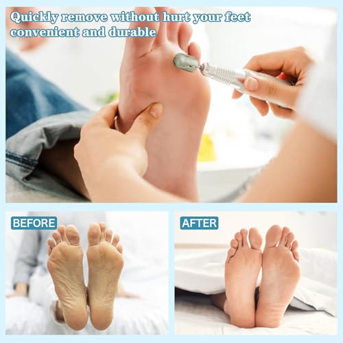 Pedicure Drill Bit,16mm diameter 180Grit Diamond Carbide Foot Nail Drill Bit Pedicure Foot Calluses Sanding Polishing Head for Cracked Skin Corns Callus Removal for Home Salon & DIY 16mm #180