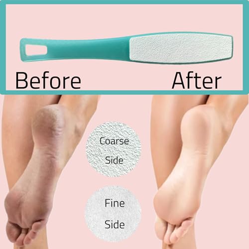 3 ALAZCO Double Sided Foot File Pumice Ergonomic Handle Scrubber Immediate Result Smooth Feet Heel Scraper Exfoliate Buffer Dead Skin Callus Corn Emery Fine & Coarse Pedicure Tool Blue X3