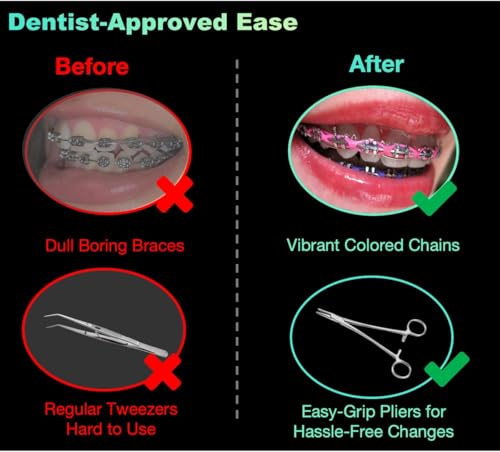 Dental Braces Color Changing Kit, 5 Rolls Continuous Braces Power Chains Orthodontic Pliers Changing kit, Change The Color of Your Braces Yourself in Minutes Ligas para Brackets Ortodoncia