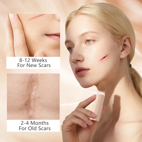 2pcs Scar Solutions Silicone Scar Stick, Made of 60% Silicone, Lightweight & Easy to Apply, Gentle on All Skin Types