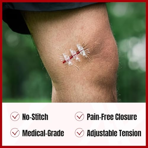 RHINO RESCUE Wound Closure Kit with 3 Types Butterfly Bandages 78pcs