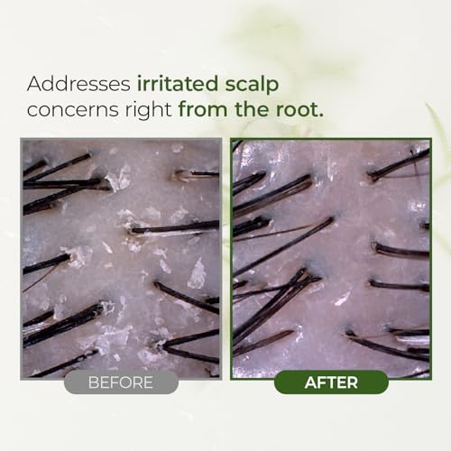 STEAMBASE Tea Tree Scalp Treatment | Purifies and Exfoliates Oily Scalp | Natural BHA & Tea Tree | Removes Odor & Buildup | Hypoallergenic Exfoliator, 8.42 fl oz Tea Tree Scalp Water Scaler Full Size, 8.45 fl oz