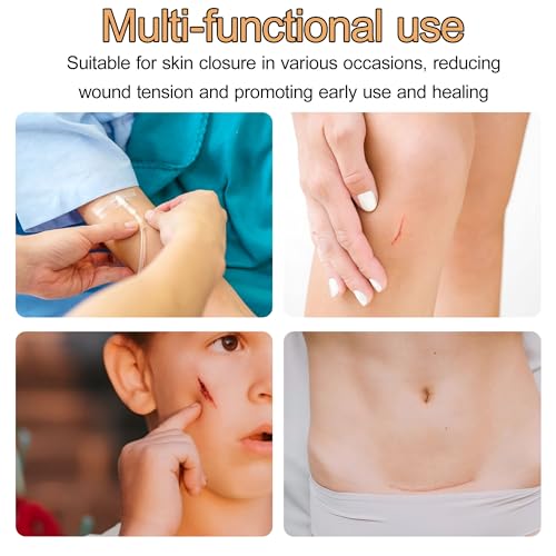 Sterile Strip Wound Closure Strips, 1/4" x 4" Adhesive Skin Closures, Breathable Non-Woven Laceration Closure Kit for Emergency Wound Care, Minor Cuts & Scars Reduction (20pcs(White)) 20pcs(white)