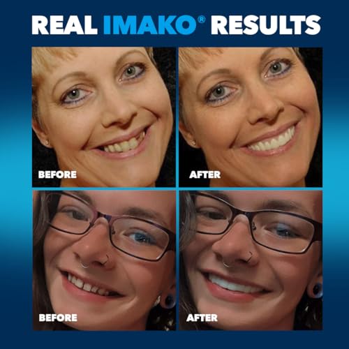 Imako Premium Cosmetic Uppers for Men and Women – Temporary Smile Makeover - 1 Pack - Large, Bleached White - Made in USA Large Bleached White