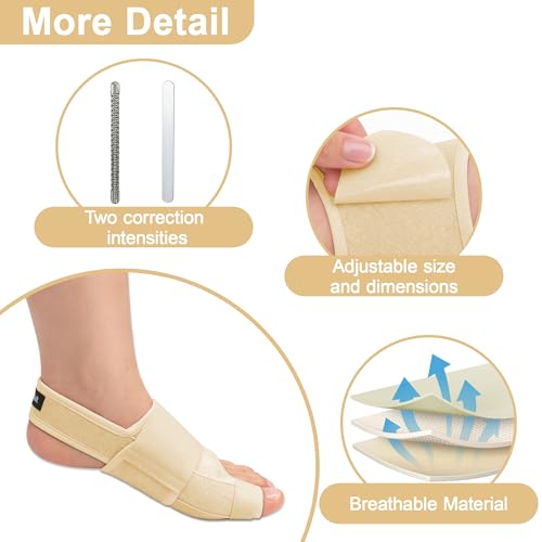 SPRING SEAON 2-Pack Bunion Corrector Adjustable Toe Splint Day/Night Beige