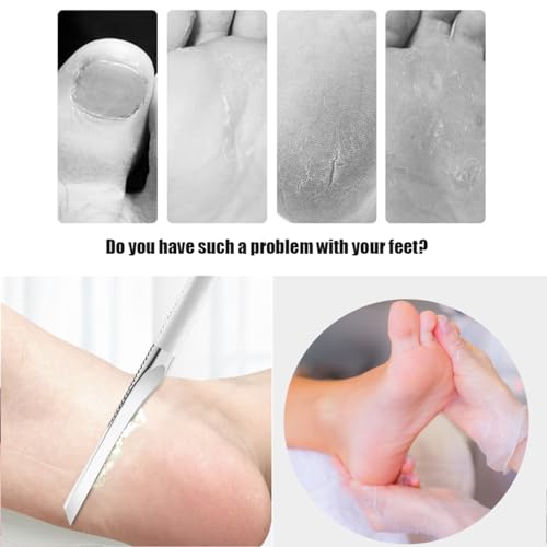 Stainless steel ingrown toenail pedicure knife set,professional foot skin scraper repair sharp blade kit for nail corn callus paronychia treatment. (3), Silver