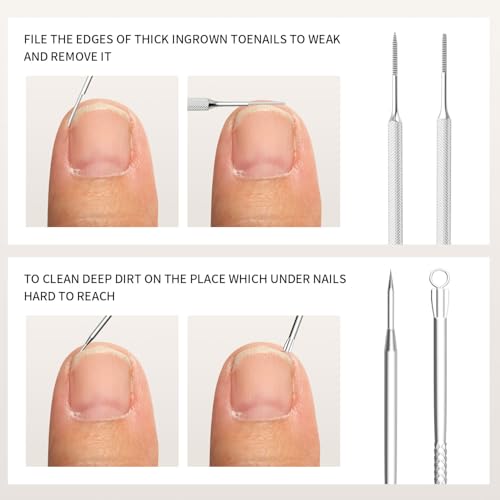 ZIZZON 7 Pcs Ingrown Toenail File and Lifters Set, Stainless Steel Ingrown Toenail Removal Kit, Under Nail Cleaner Pedicure Tools 7pcs