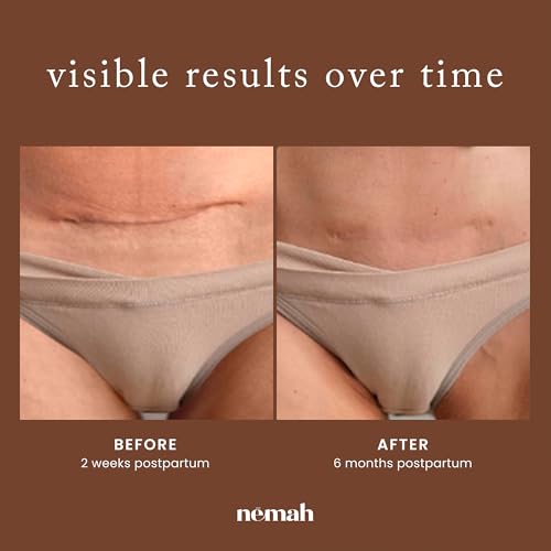 Nemah Restorative Scar Treatment, C Section Recovery, Surgical Scars, 1 Oz 1 Ounce