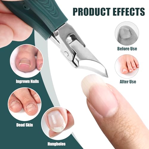 3pcs Ingrown Toenail Clippers Set, Professional Slanted Beveled Eagle Beak Curved Nail Clippers with File & Tear Tool for Thick Nails & Seniors (Green) Green, Silver