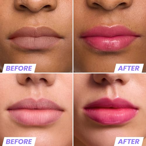 Wonderskin Lip Oil Rehab Serum - Tinted Lip Oil, Hydrating Lip Serum Kissed