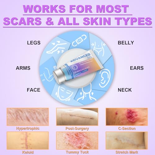 Silicone Scar Cream Scar Gel - Advanced Scar Treatment Keloid Bump Removal for Surgical Scars, C-Section, Injury, Stretch Marks, Acne, Burns, Keloids, Old & New Scars, 1.23Oz (35g) White