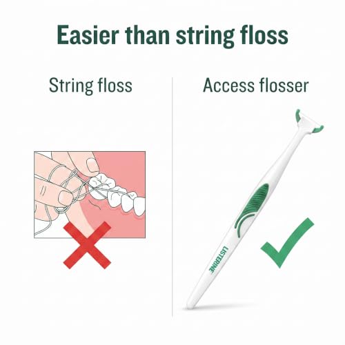 Ultra Clean Access Flosser for Hard-to-Reach Back Teeth, Reusable Floss Handle with 28 Disposable Mint Refill Heads, Long Handle Flossing Tool for Adults 1