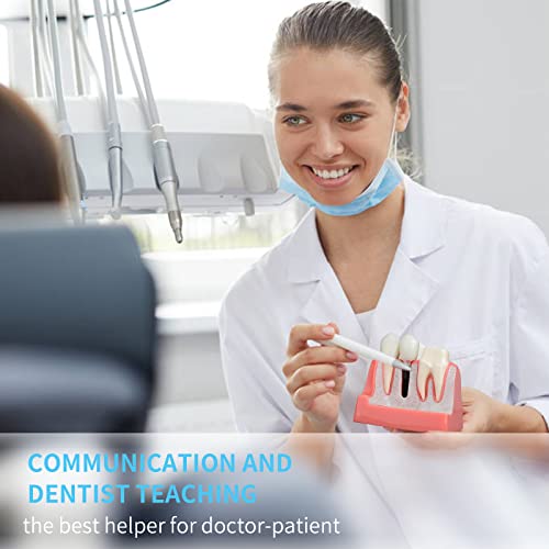 ANNWAN Dental Implant Model 4 Times Removable Analysis Crown Bridge Demonstration Teeth Model for Class Education and Studying Teeth Model