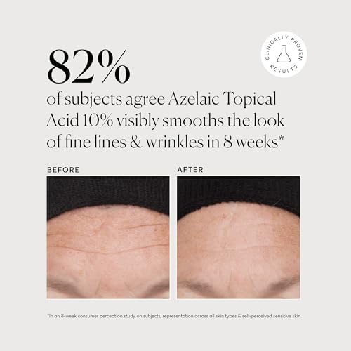 Naturium Azelaic Topical Acid 10% Serum, Niacinamide & Vitamin C, 1 fl oz 1 Ounce (Pack of 1)