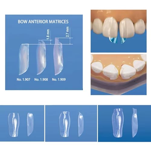 Dental Clear Matrix Bands, BT Anterior Matrices Bioclear Style, Diastema Transparent Sectional Matrice System (1908) 1908