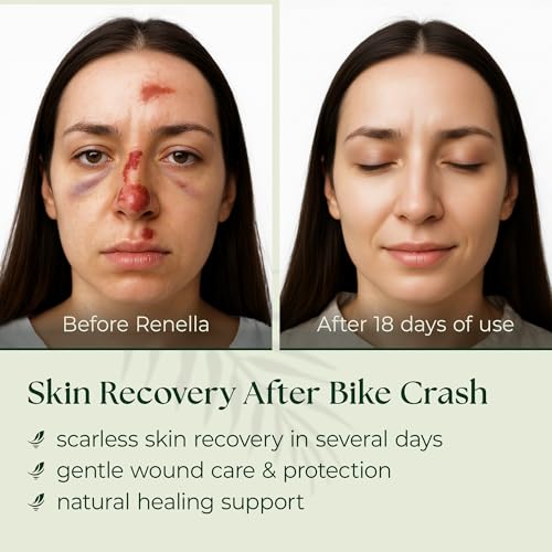 SCARLESS SKIN RECOVERY NATURAL FIRST AID GEL for Burns & Wounds First Aid Gel for Cuts, Scrapes & Burns – Advanced Skin Repair Ointment Soothing Film-Forming Barrier – Fragrance-Free