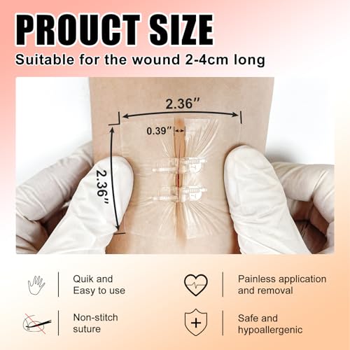 Carbou 4 Pcs Zip Sutures Wound Closure Device + 10 Pcs Silicone Foam Dressing with Gentle Border 4"x4"