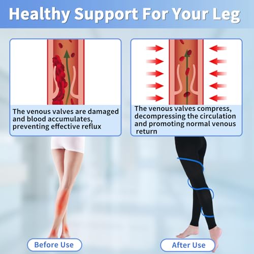 Medical Compression Leggings for Women & Men, 20-30mmHg Compression Tights X-Large Footless/Black