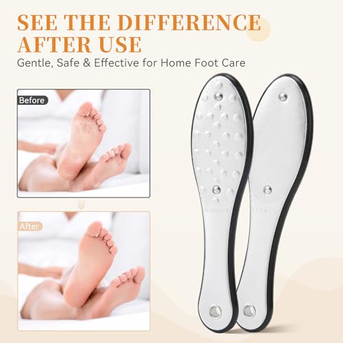 Dual-Sided Foot File Callus Remover (1 PCS), Metal Foot Scraper Black