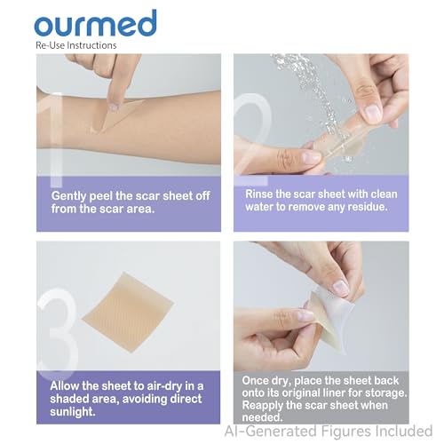 Ourmed Silicone Scar Removal Sheets (1.6" x 6", Pack of 5) Medical Grade Silicone Scar Removal Sheets, Hypoallergenic for New and Old Scars – Surgery, Burns, Acne, Keloids, Stretch Marks, C-Section 1.6"x 6" (5 Pcs)