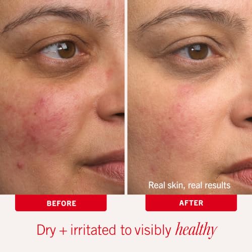 First Aid Beauty Ultra Repair Cream, Intense Hydration 4 Ounce (Pack of 1) New
