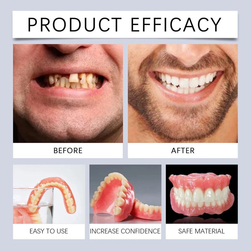 Moldable False Teeth,Dentures for Women and Men Veneers Teeth Silicone Dentures Set for Both Upper and Lower, Temporary Dentures DIY at Home Within Minutes Fix Your Smile