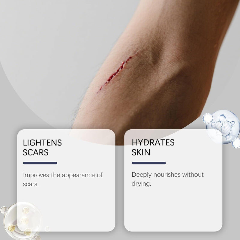 Scar Stick, Scar Solutions Silicone Scar Stick, Thick Solid Velvety Film for Old, Burn Scars, Acne, Stretch Marks, Formula Infused with Asiatica Extracts and Vitamin E for Skin Smoother, Softer