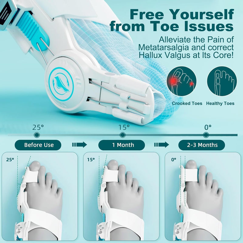 Bunion Corrector for Women & Men - Bunion Fix for Hallux Valgus Pain Relief with Non-Slip Big Toe Separator, Adjustable Big Toe Straighter, Bunion Splints Fits Left & Right Feet (White 1Pcs) White 1