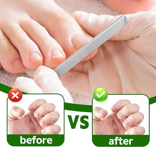Metal Nail File Kit - 4PCS Professional Stainless Steel Long Nail Files