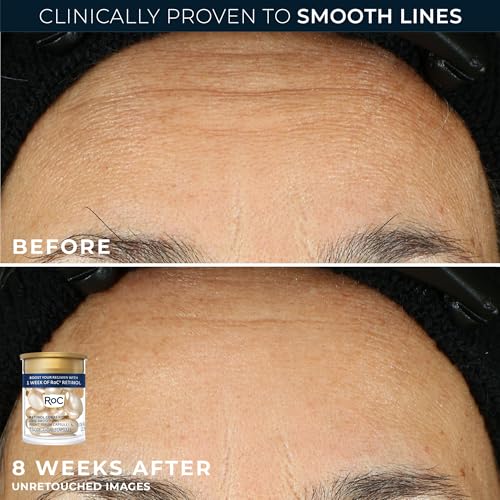 RoC Clinical Mini Retinol Anti-Aging Skincare Routine Kit with Line Smoothing Eye Cream, Serum Capsules, and Max Hydration Face Cream for Wrinkles and Dark Circles