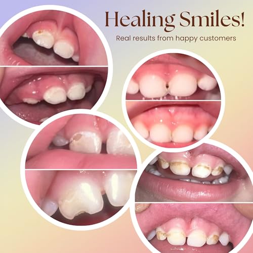 Bliss Energetics Remineralizing Tooth Puddy | Fluoride-Free with Hydroxyapatite | Remineralization | All Natural Ingredients & Preservative Free | Mineral-Rich Spot Treatment 1oz 1 Ounce (Pack of 1)